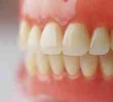 Акрилни зъбни протези: предимства и недостатъци, прегледи