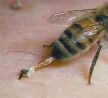 Алергия към пчелните ужилвания: първа помощ, последици