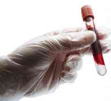 Кръвен тест за хемостаза е какво?