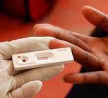 Тест за ХИВ: времето на готовност, къде и кога да предприемете