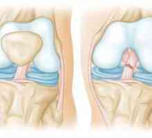 Анатомия на колянната става. Чанти за коляно