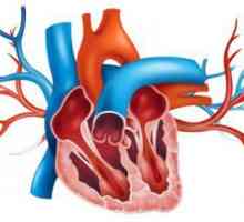 Аортата е уплътнена - какво означава това? Лечение на аортно уплътняване