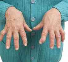 Остеоартрит на пръстите: симптоми и лечение