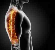 Остеоартрит на гръбначния стълб: диагноза, симптоми и лечение