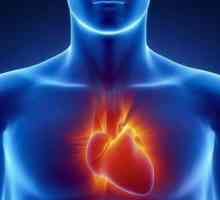 Асистията на сърцето - какво е това? Симптоми, причини, спешно лечение, лечение