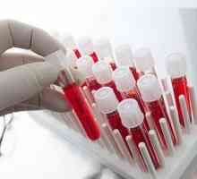 Азот, остатъчен в биохимията на кръвта