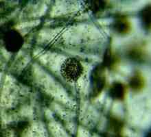 Бактерии и микроби под микроскоп (снимка)