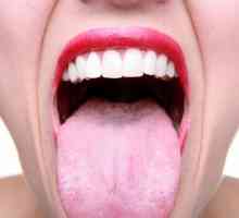 Бяло покритие на езика на възрастните: причини и лечение