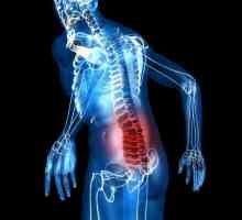 Болка в сакралния гръбнак на жените: причини, диагноза, лечение