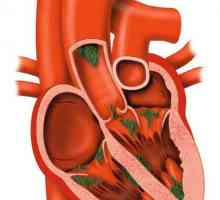 Болест на осезаемото сърце: симптоми и лечение