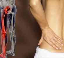 Болка в гърба, причиняваща крака: причини, лечение