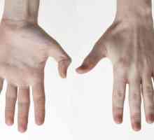 Части на ръката: характеристики на анатомията