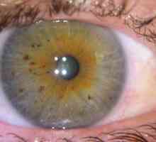 Черните точки в очите: какви са причините и характеристиките на лечението