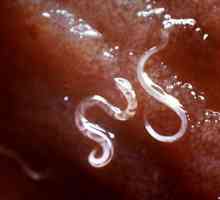 Червеите в човека. Кръгли червеи-паразити: лечение и профилактика