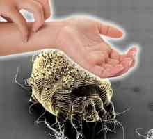 Скраб от червеи при хора: лечение, първи признаци, начини на инфекция. Мехлем от червеи акари