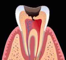 Какво ще стане, ако зъбът боли, когато го докосна?