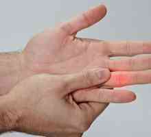 Какво да направите, ако почукате пръста си: симптоми, първа помощ
