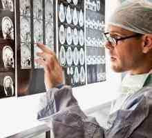 Какво представляват неврохирурзите: описание на медицинска специалност