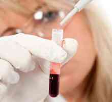 Какво означава кръвният тест на АФП? Алфа-фетопротеин: транскрипт
