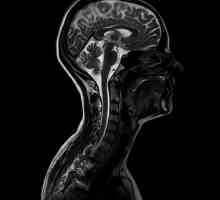 Какво показва MRI на шията? ЯМР на лимфни възли, съдове и меки тъкани на шията