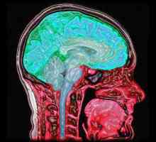 Каква е диагнозата на ЯМР? Възможности за MRI-диагностика. Диагностика на ЯМР на мозъка. Отзиви за…