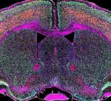 Какво представлява моторния неврон?