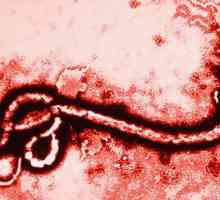 Какво представлява Ебола и как се предава вирусът на хората?