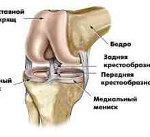 Какво представлява ЯМР на колянната става, как показват MRI на колянната става?