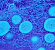Какво представлява патогенната гъбичка?
