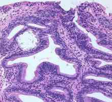 Cystitis: признаци и фактори, допринасящи за появата на болестта