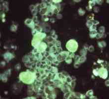 Цитомегаловирус: какво е това и колко опасно е заболяването?