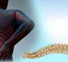 Деформация на гръбнака: видове, причини, лечение и профилактика