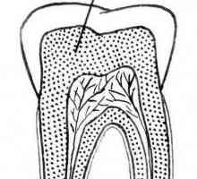 Dentin - какво е това? Видове, структура, състав и характеристики на лечението
