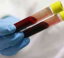 Диагностика на заболяванията. Биохимичен кръвен тест: какво ще покаже?