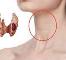 Дифузивни промени в щитовидната жлеза: Симптоми, възможни причини и характеристики на лечението