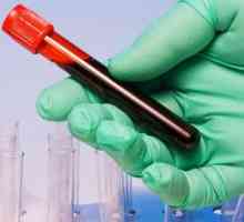 Защо кръвният тест е необходим за онкологията?