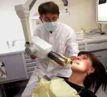 Какво е рентгеново изследване за зъбите?