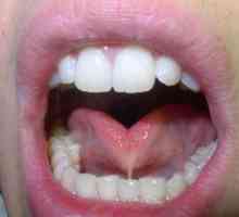 Дъното на устната кухина (анатомия). Устна кухина: структура, физиология