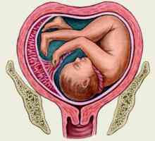 Двойночервена матка и бременност: вероятността да забременее, признаците на бременността,…