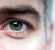 Eyeball - какво е това? Склероза на лещата на окото: причини, симптоми и лечение