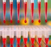 Хемоглобин в кръвния тест: обозначение. Обяснение на кръвния тест