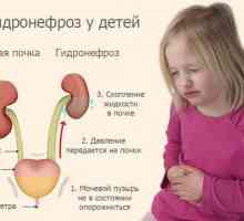 Хидронефроза при деца: степен, симптоми, лечение, операция