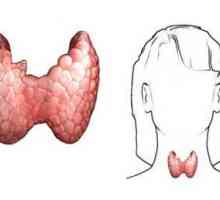 Хипертиреоидизъм на щитовидната жлеза: причини, симптоми, диагноза, лечение