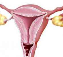 Хипертрофия на шийката на матката: основните причини и етапи