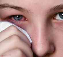 Очите са подути и сърбящи: причини и лечение