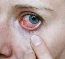 Червеи в очите: причини и диагностика