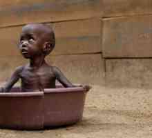 Гладът в Африка