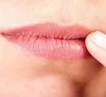 Халит на устните: видове, причини и лечение