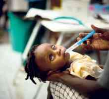 Холера е ... Холера: причини, симптоми, диагноза и лечение
