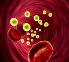 Холестеролът в кръвта: норма за жените и мъжете
